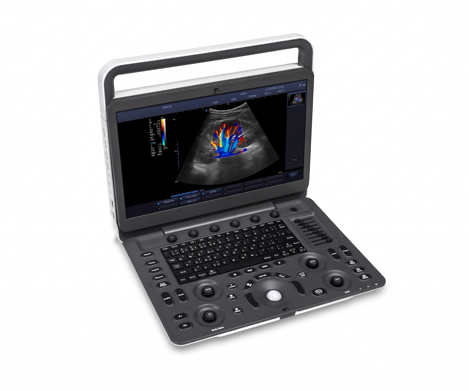 ProSonna XP2 Ultrasound
