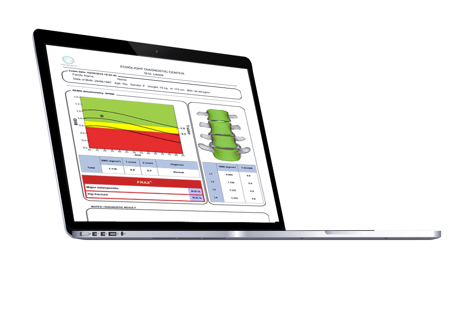 BMD Density Measurement
