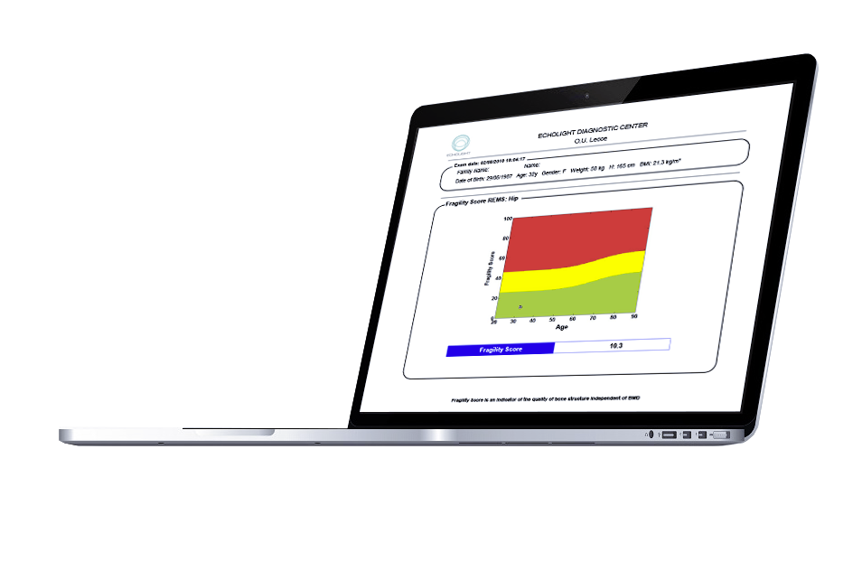 Fragility Score Assessment
